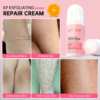 Keratosis Pilaris Lotion For Rough Bumpy Skin