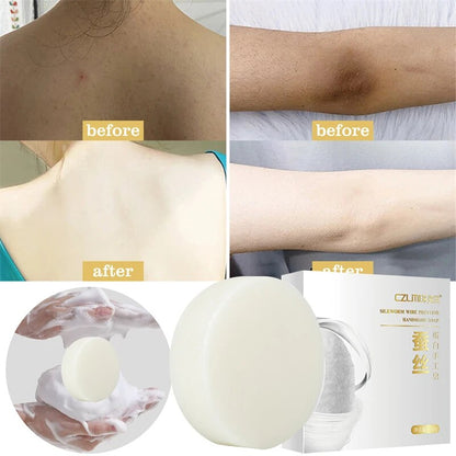 Body Whitening Soap For Underarm, Chicken Skin Removal & Dark Spot Removal